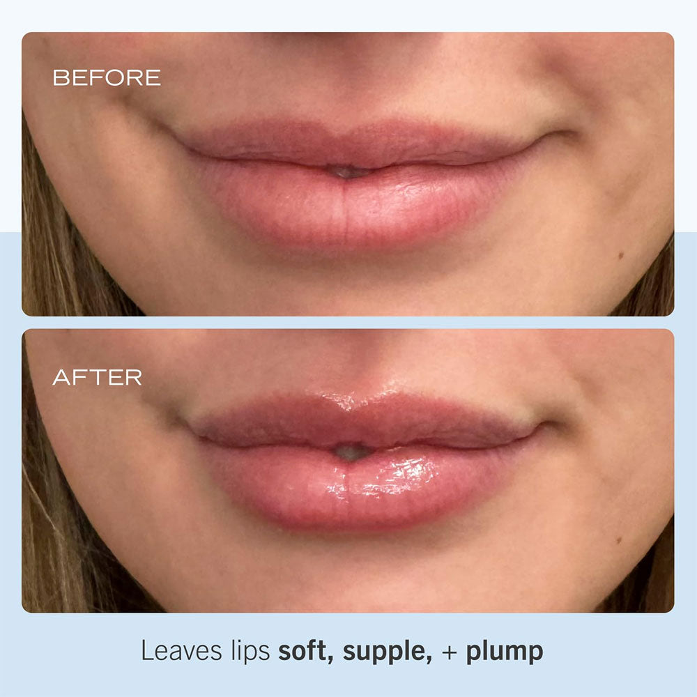 First Aid Beauty Ultra Repair Lip Balm