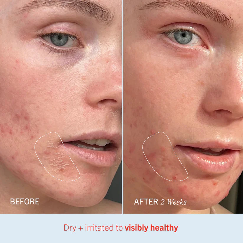 First Aid Beauty Ultra Repair Cream Intense Hydration 170.1g