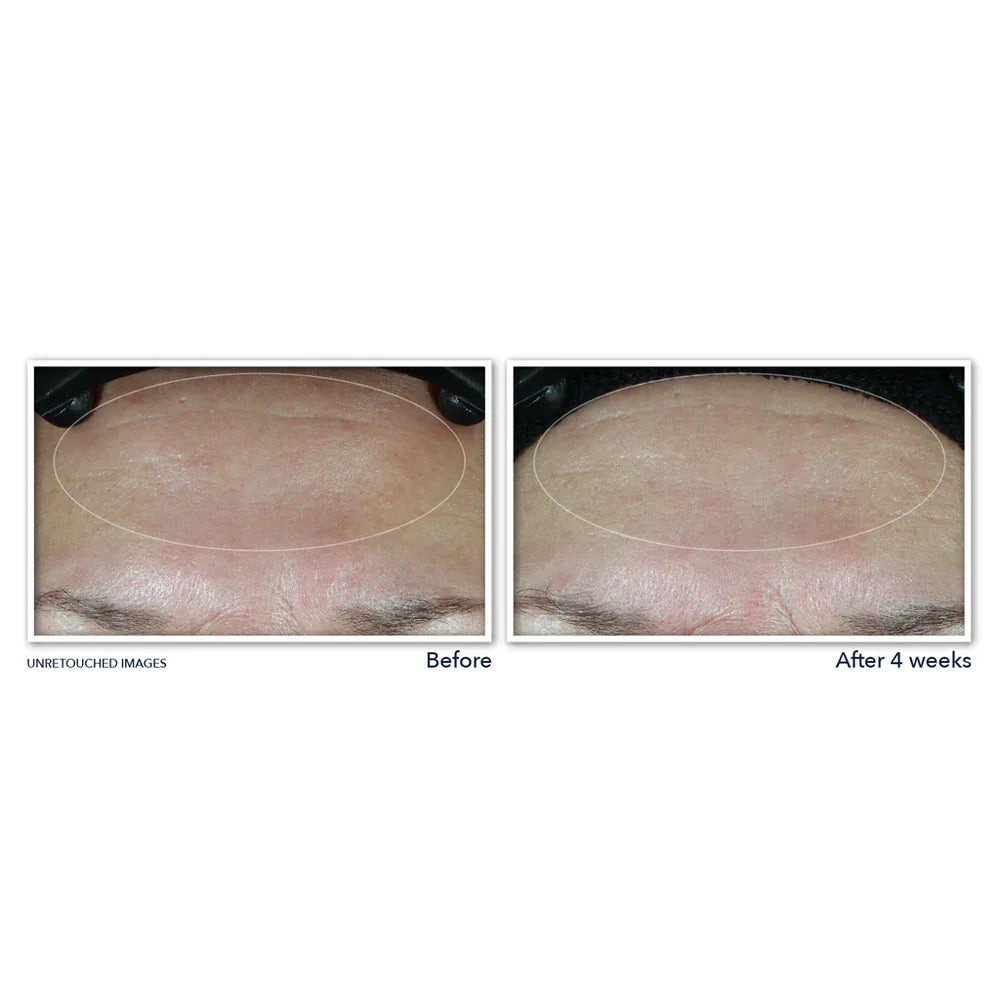 RoC Multi Correxion® Hydrate + Plump Moisturizer with SPF 30, 50ML