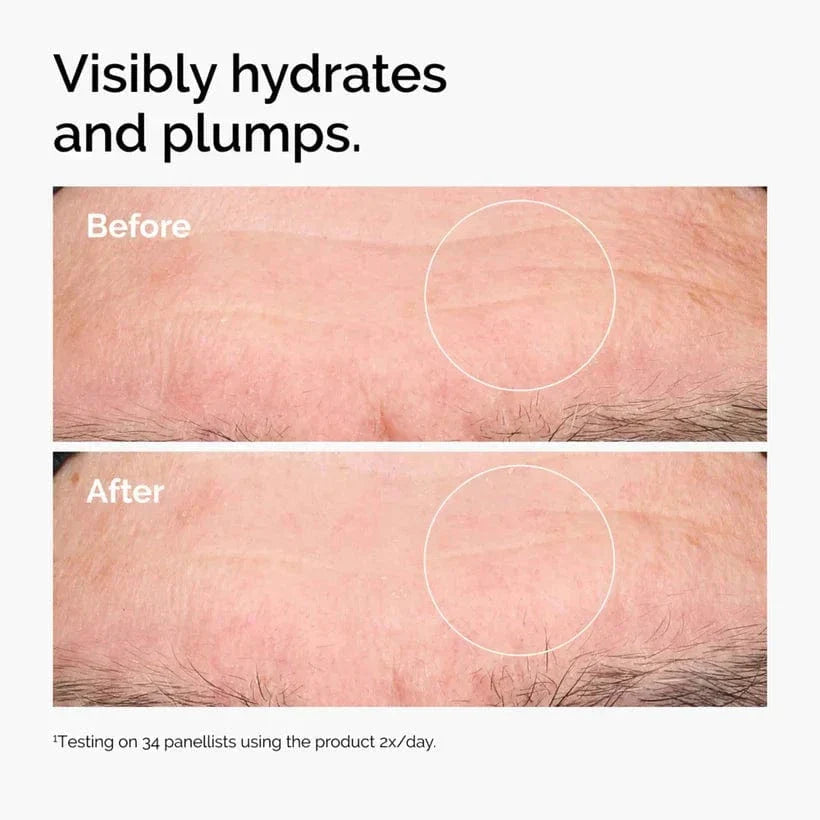 The Ordinary Hyaluronic Acid 2% + B5 30ml